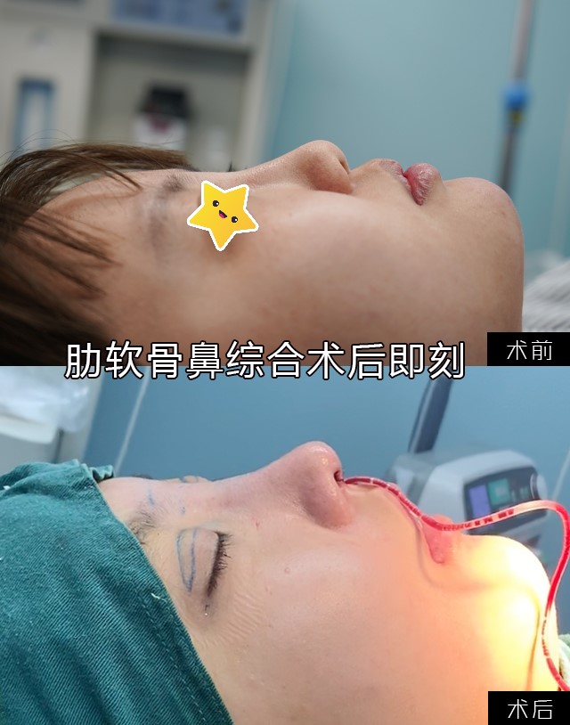 ���·尸��