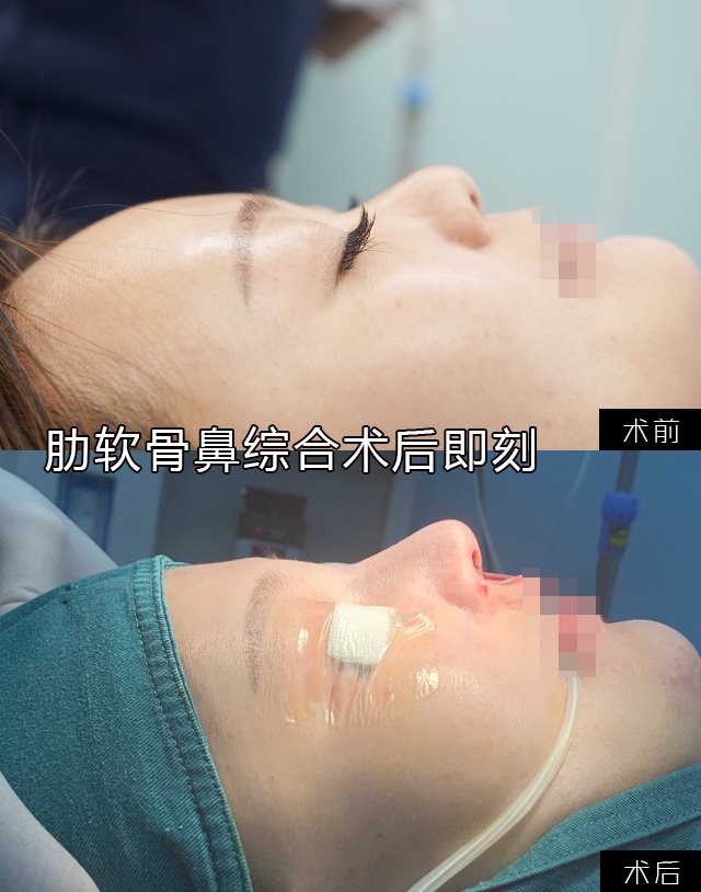 ���·尸��