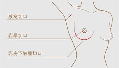 ͼƬ2.png