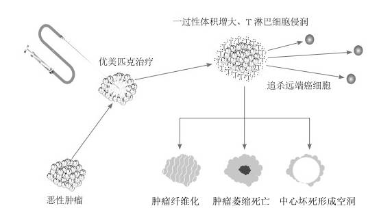 ������������ҽԺ���Ϳ��Ʒ���www.beijingcancer.com